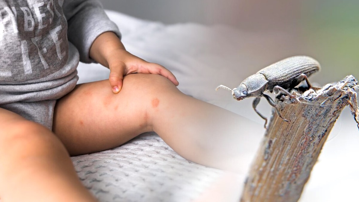 Elles adorent la chaleur et les tissus » : pourquoi les punaises de lit sont les reines de vos vacances d’été