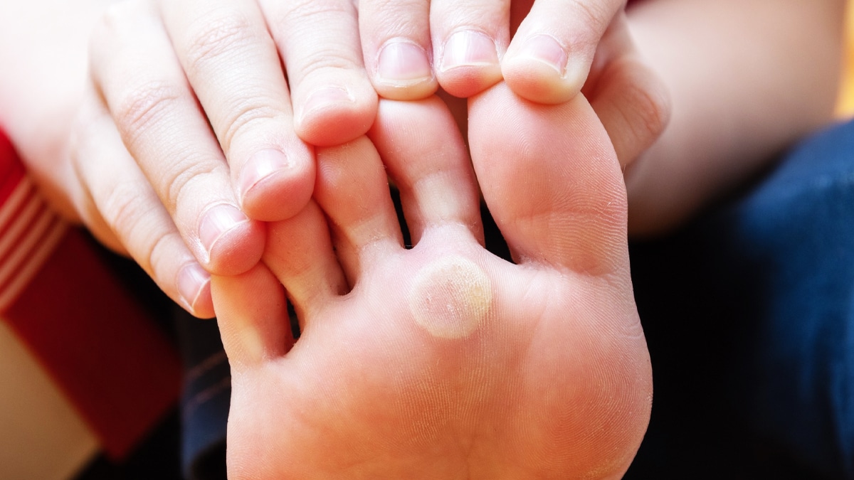 “J’ai cru que c’était une cloque de chaussure” mais c’était une morsure de tique et j’ai été traitée pour “une forme de Lyme atypique”