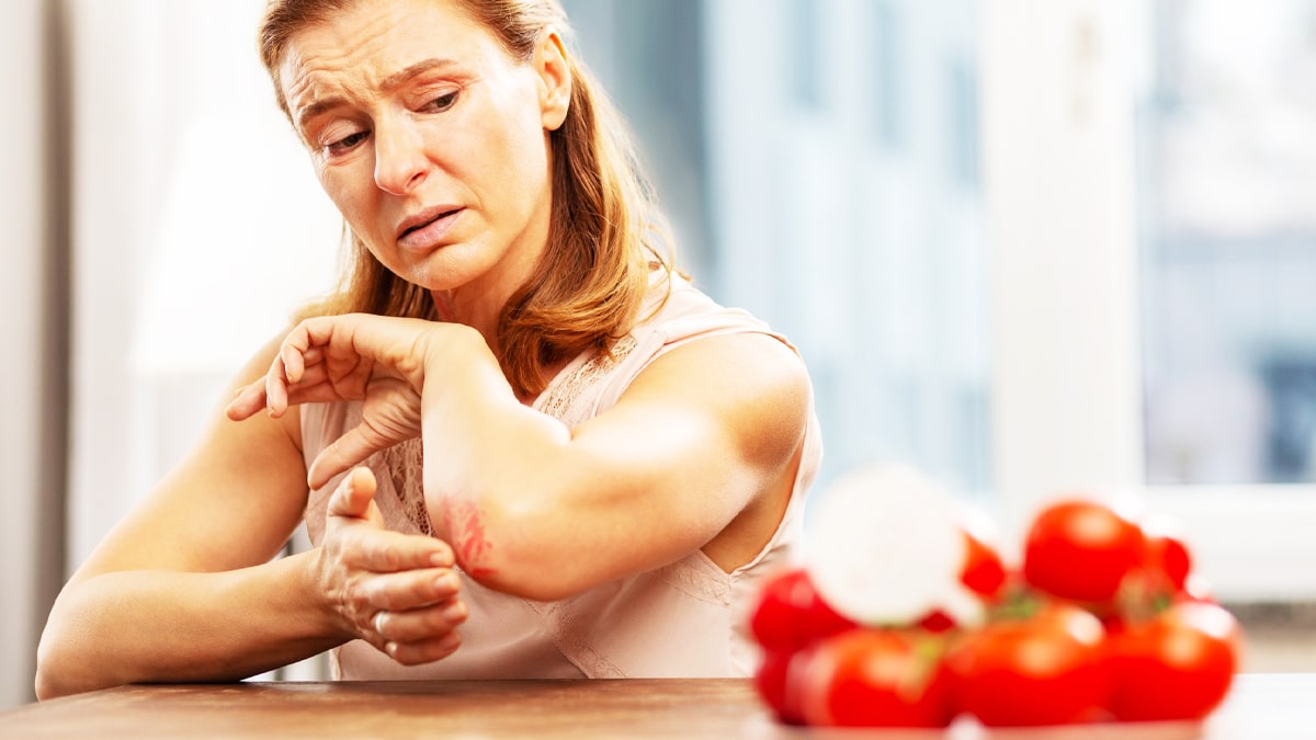 “J’ai cru que c’était une allergie alimentaire” jusqu’au moment où mon visage a doublé de volume après un simple fruit et l’allergologue m’a dit très calmement “vous devez désormais toujours avoir un stylo d’adrénaline sur vous”
