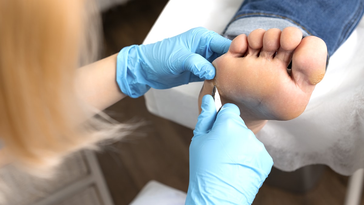 “J’ai cru que c’était juste une coupure au pied” mais ce n’était pas une coupure, c’était un mycète sous-cutané et le dermato m’a dit “on va devoir gratter et traiter fort”