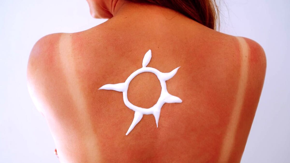 “Je pensais que c’était un simple coup de soleil” mais c’était une infection et j’ai fini sous perfusion pendant trois jours