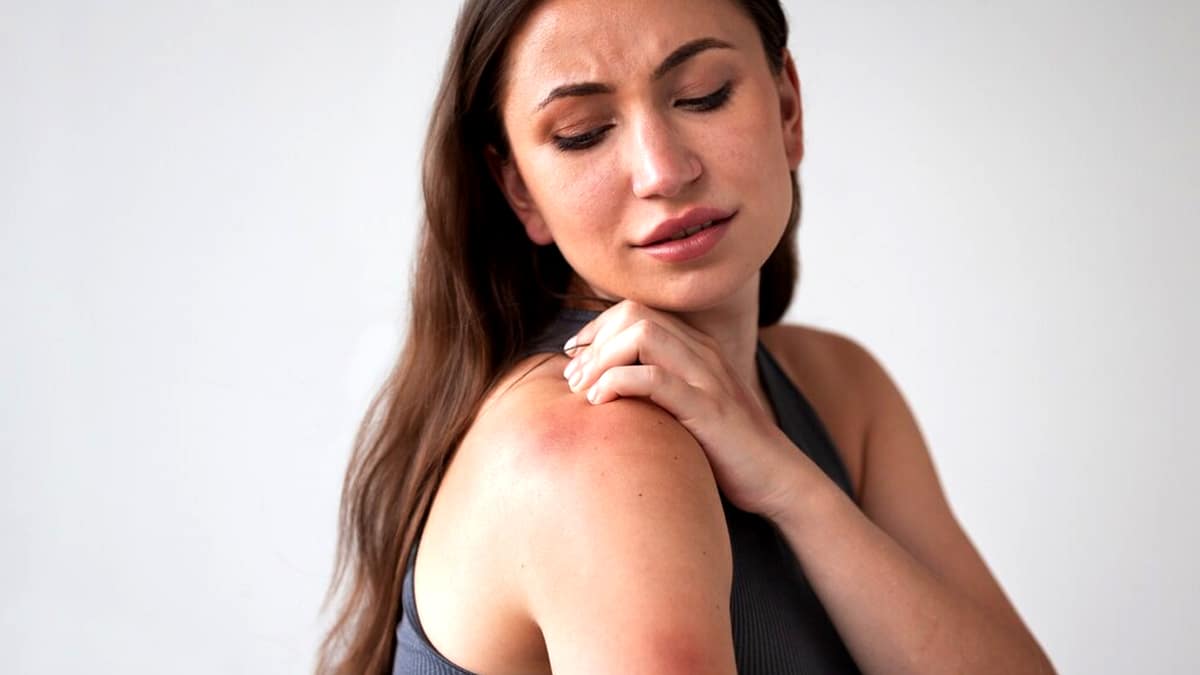 “Je croyais que c’était un bouton de chaleur” mais c’était une infection cutanée grave nécessitant une opération
